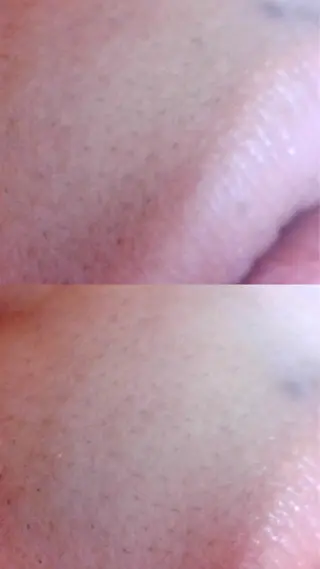 Hit. シュガーリング豊橋のエステ・リラクイメージ