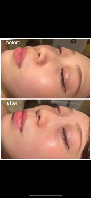 青山・表参道/ 💎肌質改善/inoのその他イメージ