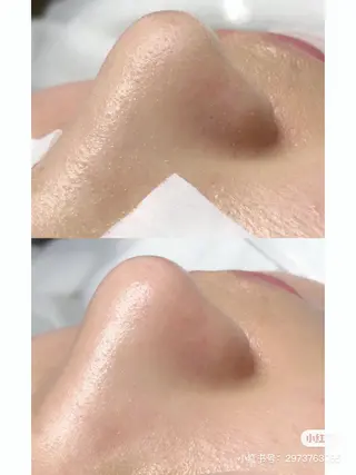 ネイル aliaハイフ&水光ジェットサロン所属・aliaハーブ水光店 エステティシャン募集のエステ・リラクイメージ