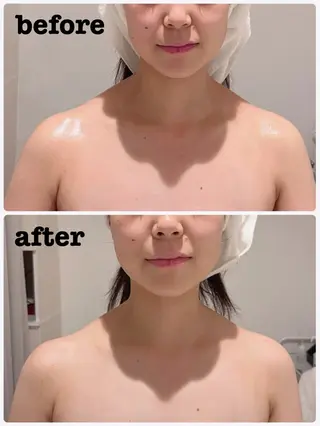 POLA THE BEAUTY 堺東店所属・肌管理🌿毛穴改善 POLA堺東のエステ・リラクイメージ