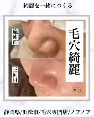 NoANoA Naguraの眉毛・アイブロウイメージ