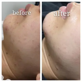 🅖🅤🅩🅔🅛 salonのエステ・リラクイメージ