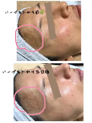 ダイエット／脱毛 美顔／フォト／ハーブのその他イメージ