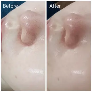 肌質改善Beauty salon Renのエステ・リラクイメージ