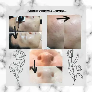 男女同額完全個室脱毛 LEPIA内田のエステ・リラクイメージ