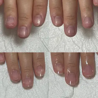 ネイル 自爪育成・巻き爪 補正講師　津蔵のネイルデザイン