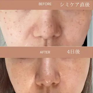 肌質改善エステ chiffonのエステ・リラクイメージ