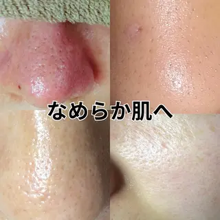 エステサロン Lazulisea所属・川口 春奈のエステ・リラクイメージ