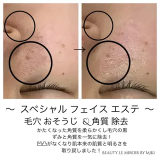 ビューティー ミロワールのエステ・リラクイメージ