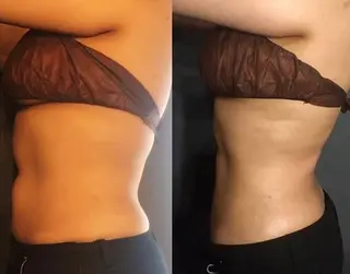 小顔＆痩身✨長谷川 ノリコのエステ・リラクイメージ