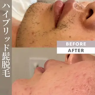 メンズ Amm所属・🏆艶肌ワックス🏆 ララピール✨Ammのエステ・リラクイメージ