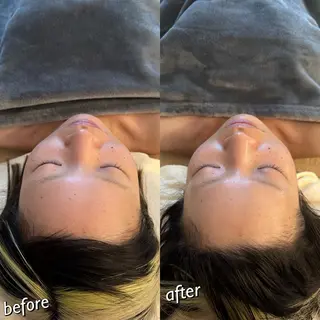 うなじ脱毛/美肌脱毛 LABELのエステ・リラクイメージ