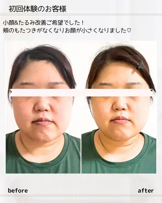 小顔矯正& 慢性肩こり腰痛改善店のエステ・リラクイメージ
