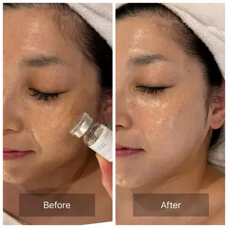 mine.mマインエム所属・mine.mi マインエムのエステ・リラクイメージ