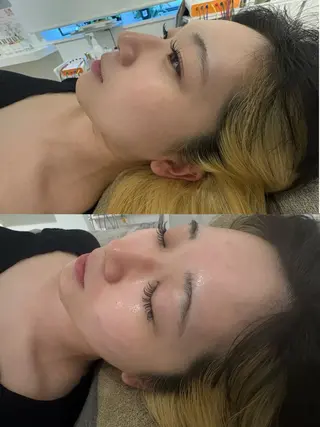 美容鍼灸サロン mahoroba院長のエステ・リラクイメージ