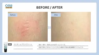 肌質改善 KALANCHOEのエステ・リラクイメージ