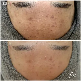 艶肌デトックス🫧 Samiraのエステ・リラクイメージ