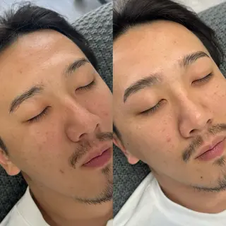 アイブロウ ARCHE-OSAKA所属・大阪心斎橋 メンズ眉毛専門の眉毛・アイブロウイメージ