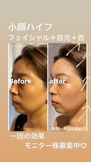 ミディアム カラー パーマ ヘアアレンジ メンズ キッズ ネイル マツエク・マツパ ルシール ユーのエステ・リラクイメージ