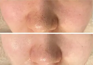 毛穴シミ改善専門 サロンド・ルパークのエステ・リラクイメージ