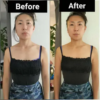 美容矯正 ＱＵＩＣＯ【キコ】のその他イメージ