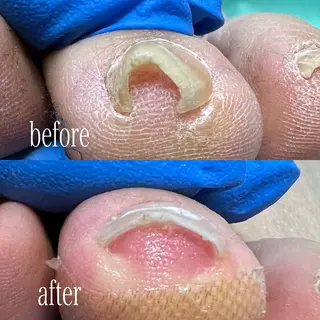 ネイル 東京巻き爪アカデミー所属・東京巻き爪 アカデミーのエステ・リラクイメージ