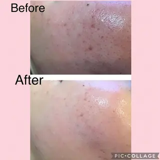 エヴァーグレース 河原町店のエステ・リラクイメージ