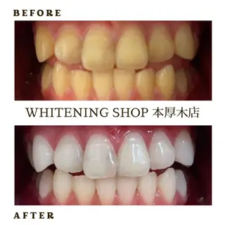 メンズ ホワイトニング ショップ本厚木のその他イメージ
