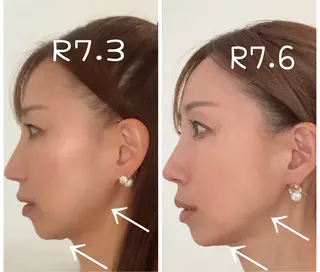 小顔と ヘッドスパのお店のエステ・リラクイメージ