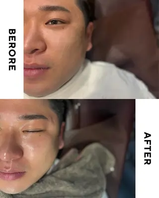 メンズ 大阪脱毛|ちぇるま| 眉毛Wax｜美肌管理のエステ・リラクイメージ