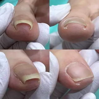 ネイル 東京巻き爪アカデミー所属・東京巻き爪 アカデミーのエステ・リラクイメージ