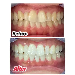 ロング メンズ キッズ ネイル マツエク・マツパ アイブロウ プラチナムビューティー柏所属・【歯科提携】柏ホワイ トニングスタイルのその他イメージ