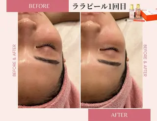 医療提携サロン&パーソナルカラー/骨格/顔タイプ診断 La chic所属・パーソナルカラー &エステ SHIHOのその他イメージ