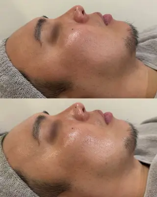 メンズ laksmi 陶肌トリートメントのエステ・リラクイメージ