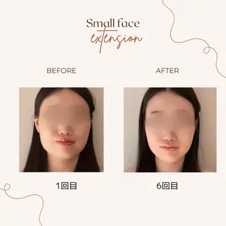 肩こり・腰痛改善専門 1万人以上施術の碧人のエステ・リラクイメージ