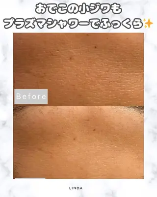 アイラッシュ&エステサロンLinda西宮所属・小顔&毛穴・肌質改善 LINDA西宮 AIのエステ・リラクイメージ