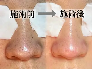 毛穴ケア専門店 esu(エス)のエステ・リラクイメージ