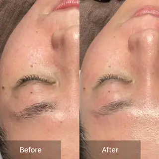 産毛専門店 Bittoのエステ・リラクイメージ