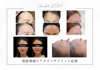 小顔/たるみ/黒ずみ除去専門サロン/SONA 大和西大寺店所属・【小顔専門看護師 サロンSONA】のエステ・リラクイメージ