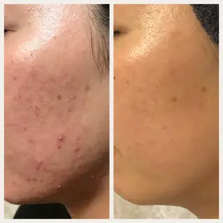 ROUN'　南 鈴沙のネイルデザイン