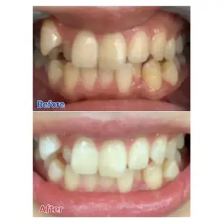 M渋谷店所属・M渋谷 ホワイトニングのエステ・リラクイメージ