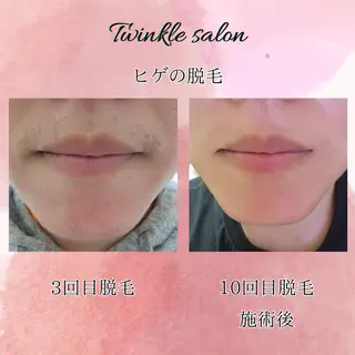 メンズ 中井 光明の眉毛・アイブロウイメージ