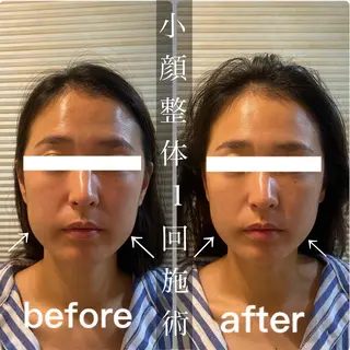 鍼灸整骨院Refine所属・鍼灸 Refineのその他イメージ