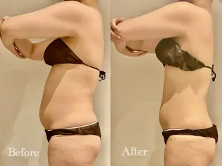 Esthetic MiEUXのエステ・リラクイメージ