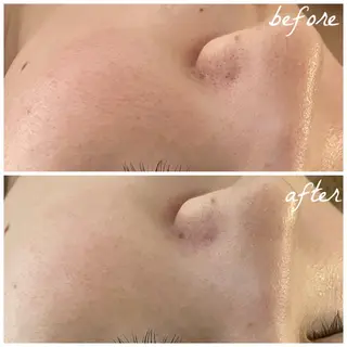 メンズ メナード岐阜市茜部 杉浦のエステ・リラクイメージ