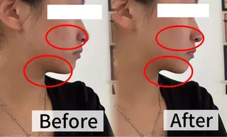 LUMINAESTH所属・LUMINA ESTHのエステ・リラクイメージ