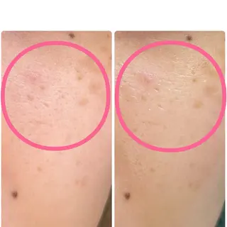 soposilma 🧸今季OPENのマツエク・マツパデザイン