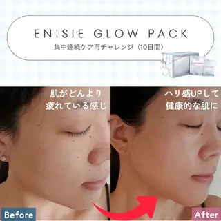 痩身ハーブピーリング 筋膜リリース☆B&Hのエステ・リラクイメージ