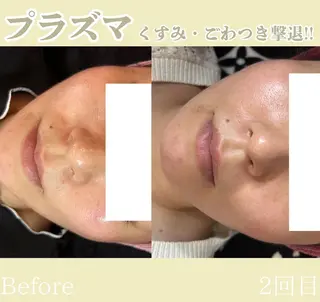 小顔矯正専門店 【RED】池田のエステ・リラクイメージ