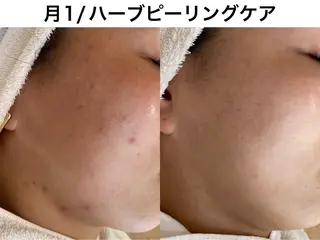 TRINIENCE 南流山店のエステ・リラクイメージ